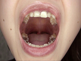 300人のおくち　3　サンプル画像07